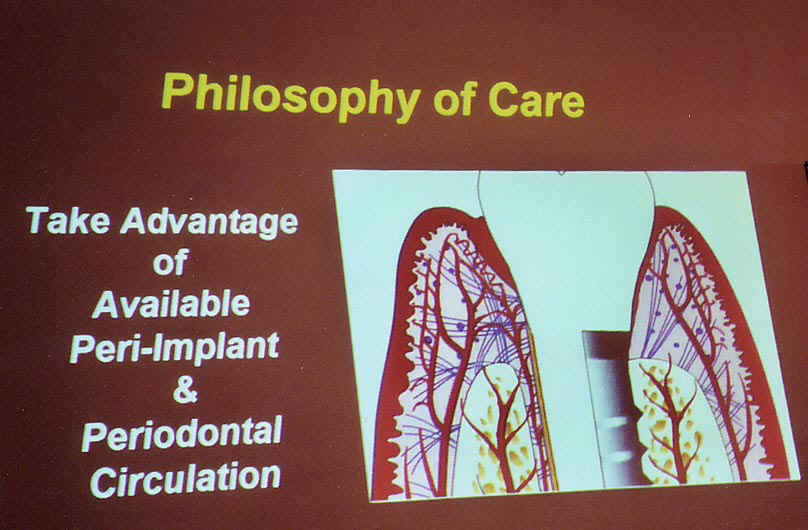 Peri-Implant.jpg (97911 bytes)